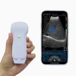 wireless ultrasound machine